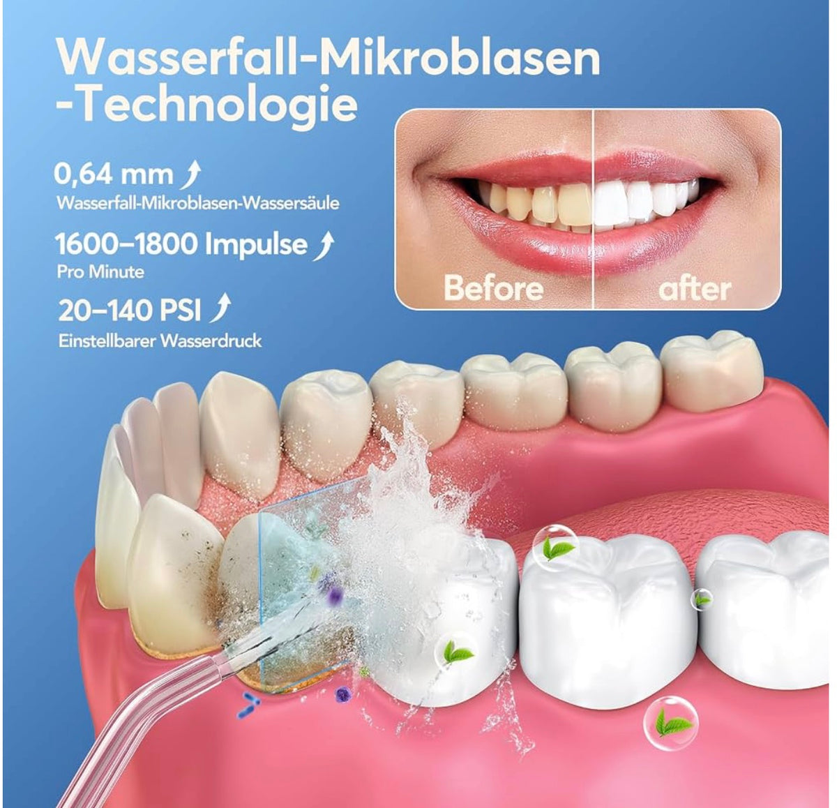 Glracd oral lrrigator